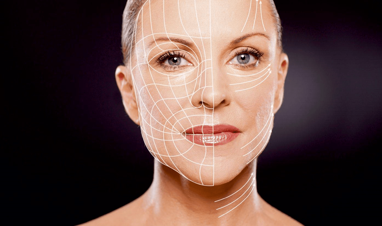 lift rejuvenation of the facial skin