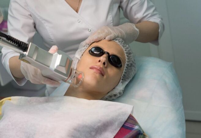Field rejuvenation with a laser